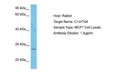 Western Blot: RUSC1 antisense RNA 1 Antibody [NBP2-84254]