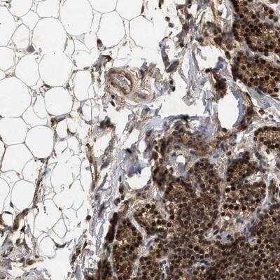 Immunohistochemistry: RUSC2 Antibody [NBP1-93639]