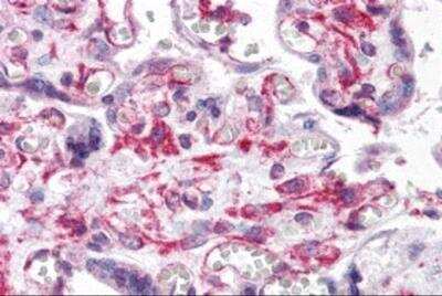 Immunohistochemistry: RUSC2 Antibody - BSA Free [NBP2-81785]