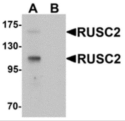 Western Blot: RUSC2 AntibodyBSA Free [NBP2-81786]