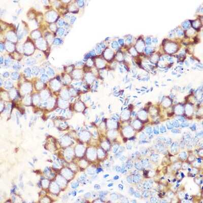 Immunohistochemistry-Paraffin: RUVBL1 Antibody (7Q2U8) [NBP3-16583]