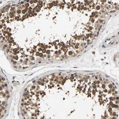 Immunohistochemistry-Paraffin: RUVBL1 Antibody [NBP1-84913]