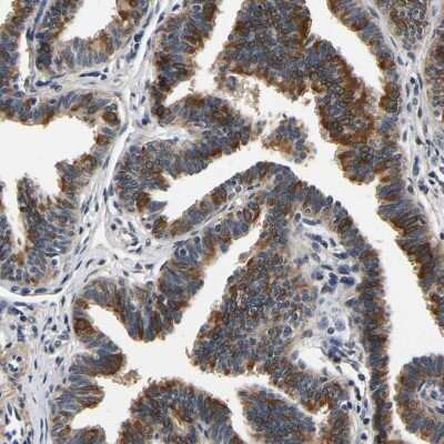 Immunohistochemistry-Paraffin: RUVBL1 Antibody [NBP1-84913]