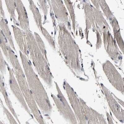 Immunohistochemistry-Paraffin: RUVBL1 Antibody [NBP1-84913]