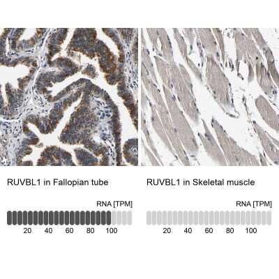 Immunohistochemistry-Paraffin: RUVBL1 Antibody [NBP1-84913]
