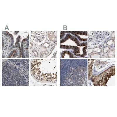 Immunohistochemistry-Paraffin: RUVBL1 Antibody [NBP1-84913]