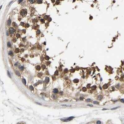 Immunohistochemistry-Paraffin: RUVBL1 Antibody [NBP1-84913]
