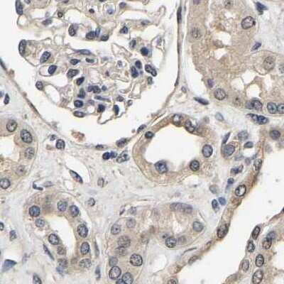 Immunohistochemistry-Paraffin: RUVBL1 Antibody [NBP1-84913]