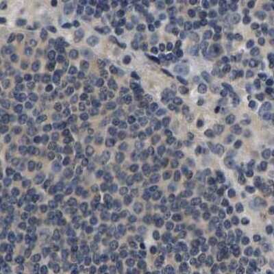 Immunohistochemistry-Paraffin: RUVBL1 Antibody [NBP1-84913]