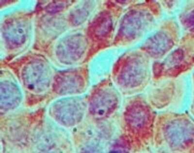 Immunohistochemistry-Paraffin: RUVBL1 Antibody [NBP2-27147]