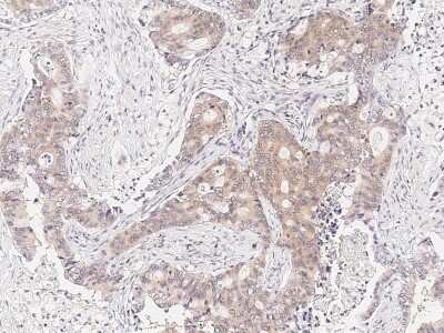 Immunohistochemistry-Paraffin: RUVBL1 Antibody [NBP2-99030]