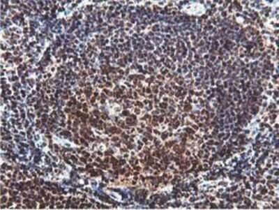 Immunohistochemistry-Paraffin: RUVBL2 Antibody (OTI1A6) [NBP2-01764]