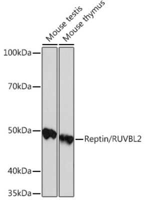 Western Blot: RUVBL2 Antibody (3U4L10) [NBP3-16361]