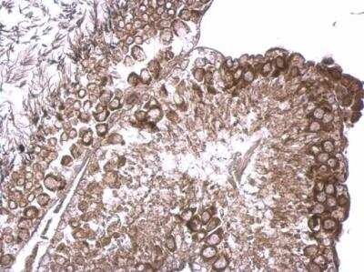 Immunohistochemistry-Paraffin: RUVBL2 Antibody [NBP1-33599]