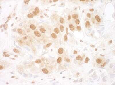 Immunohistochemistry-Paraffin: RUVBL2 Antibody [NBP1-40354]