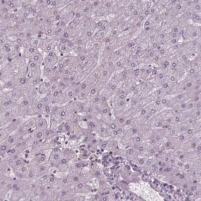 Immunohistochemistry-Paraffin: RUVBL2 Antibody [NBP2-57593]