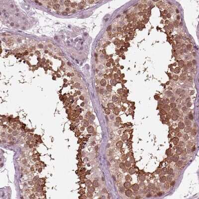 Immunohistochemistry-Paraffin: RUVBL2 Antibody [NBP2-57593]