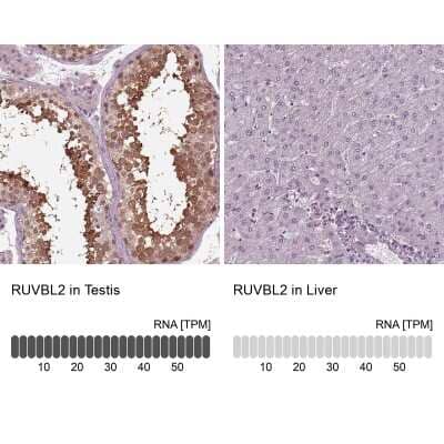 Immunohistochemistry-Paraffin: RUVBL2 Antibody [NBP2-57593]