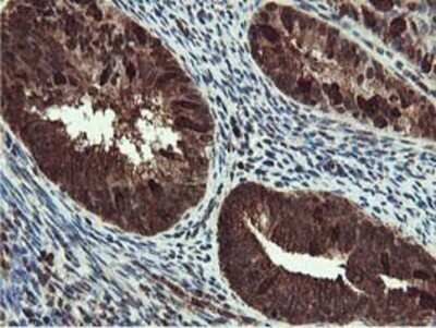 Immunohistochemistry: RUVBL2 Antibody (OTI1A6) - Azide and BSA Free [NBP2-73957]