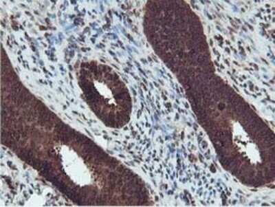 Immunohistochemistry: RUVBL2 Antibody (OTI1A6) - Azide and BSA Free [NBP2-73957]