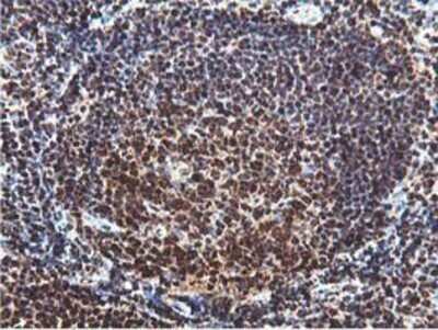 Immunohistochemistry: RUVBL2 Antibody (OTI1A6) - Azide and BSA Free [NBP2-73957]