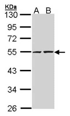 Western Blot: RUVBL2 Antibody [NBP1-33373]