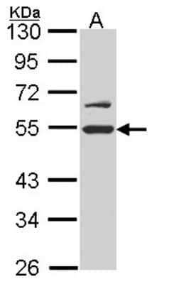 Western Blot: RUVBL2 Antibody [NBP1-33599]