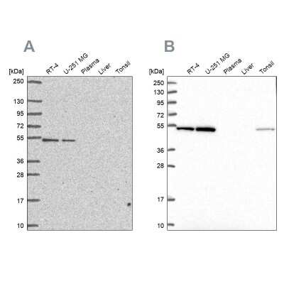 Western Blot: RUVBL2 Antibody [NBP2-57593]