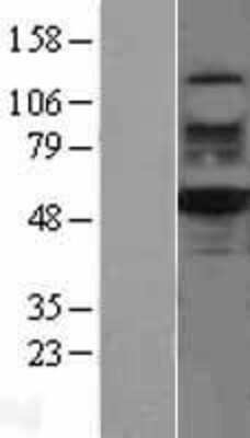 Western Blot: RUVBL2 Overexpression Lysate [NBL1-15632]