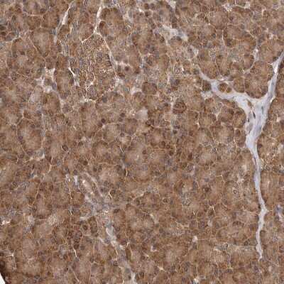 Immunohistochemistry-Paraffin: RWDD1 Antibody [NBP1-80871]