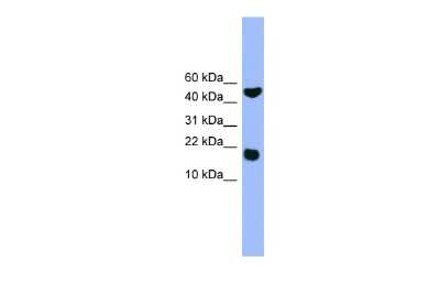 Western Blot: RWDD1 Antibody [NBP3-09377]