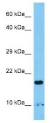 Western Blot: RWDD1 Antibody [NBP3-10273]