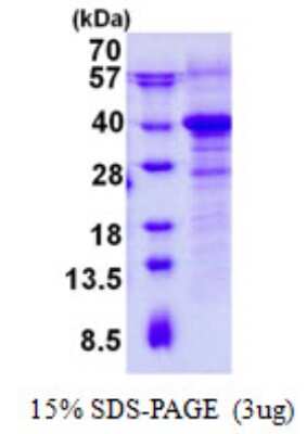 SDS-PAGE: Recombinant Human RWDD1 His Protein [NBP2-23448]