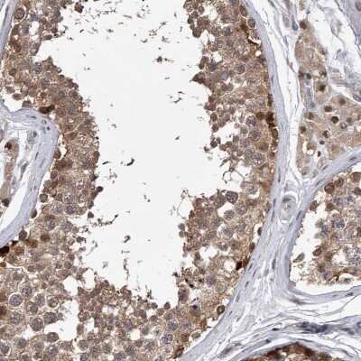 Immunohistochemistry-Paraffin: RWDD2A Antibody [NBP1-85168]