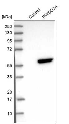 Western Blot: RWDD2A Antibody [NBP1-85166]