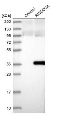 Western Blot: RWDD2A Antibody [NBP1-85167]