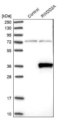 Western Blot: RWDD2A Antibody [NBP1-85168]