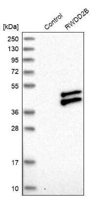 Western Blot: RWDD2B Antibody [NBP1-88272]