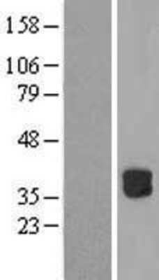 Western Blot: RWDD2B Overexpression Lysate [NBL1-15635]