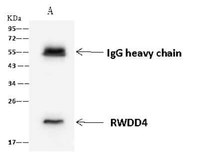 Immunoprecipitation: RWDD4A Antibody [NBP2-97777]
