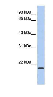 Western Blot: RWDD4A Antibody [NBP1-56461]