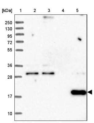 Western Blot: RWDD4A Antibody [NBP1-84743]