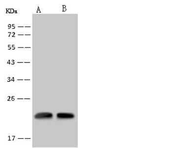 Western Blot: RWDD4A Antibody [NBP2-97777]