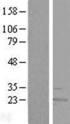 Western Blot: RWDD4A Overexpression Lysate [NBL1-15636]