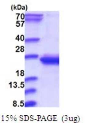 SDS-PAGE: Recombinant Human RWDD4A His Protein [NBP2-51725]