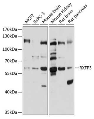 Western Blot: RXFP3/RLN3R1/SALPR AntibodyBSA Free [NBP2-93424]