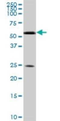 Western Blot: RXR alpha/NR2B1 Antibody (1D7) [H00006256-M05]