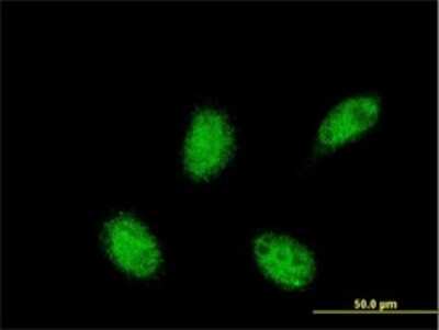 Immunocytochemistry/ Immunofluorescence: RXR alpha/NR2B1 Antibody (3A5) [H00006256-M07]