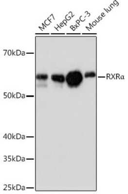 Western Blot: RXR alpha/NR2B1 Antibody (6Y10M1) [NBP3-15667]