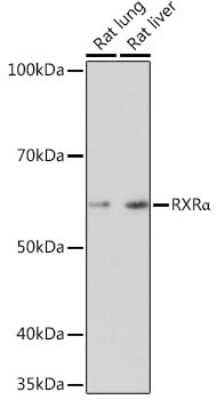 Western Blot: RXR alpha/NR2B1 Antibody (6Y10M1) [NBP3-15667]